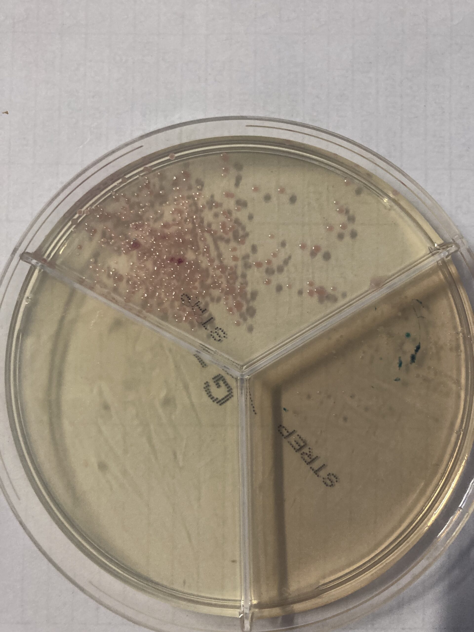 przyczyna zapaleń wymienia- Staph.aureus, agar, badanie bakteriologiczne